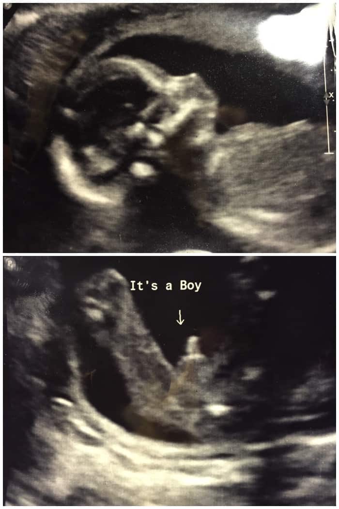 Gender Ultra Sound