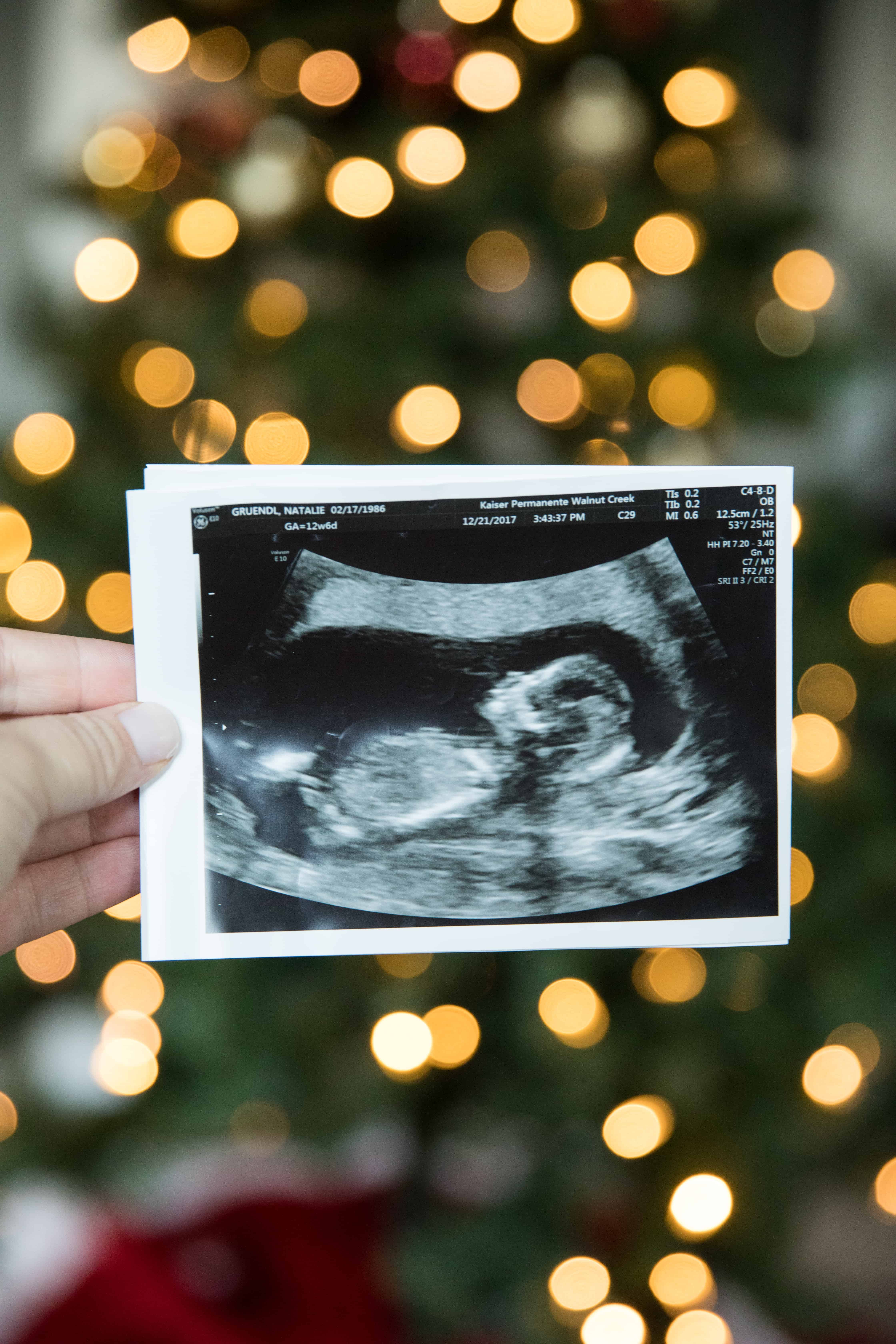 Christmas Baby Announcement